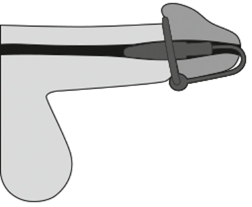 Стимулятор уретри - Penis Plug + Silicone Glans Ring Dilator