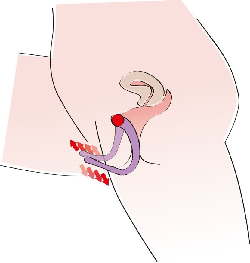 Вагинальный расширитель со стимулятором точки "G" G-spot Labia Spreader